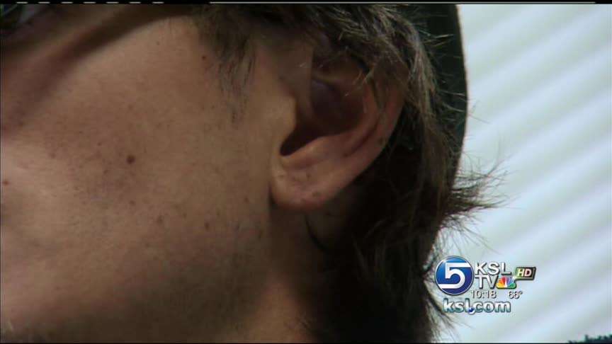 Bradford's ear after surgery