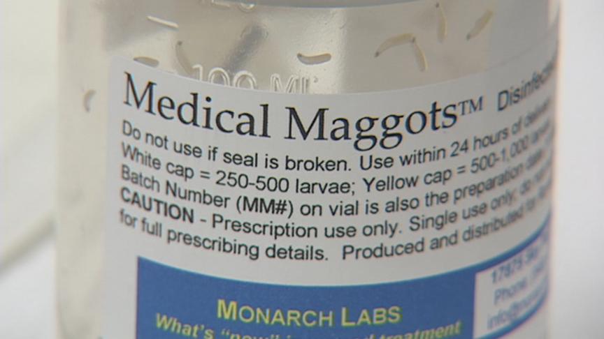 Maggots Being Used to Help Heal Wounds 