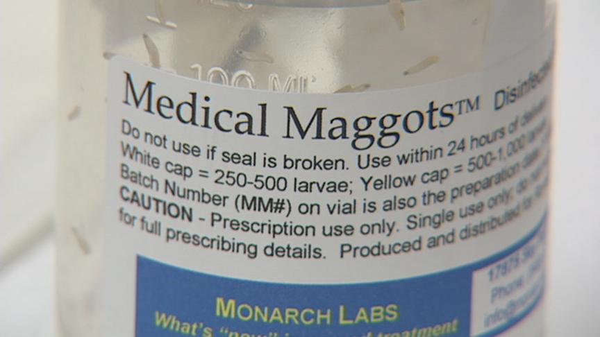 Maggots Successful in Helping Heal Wounds