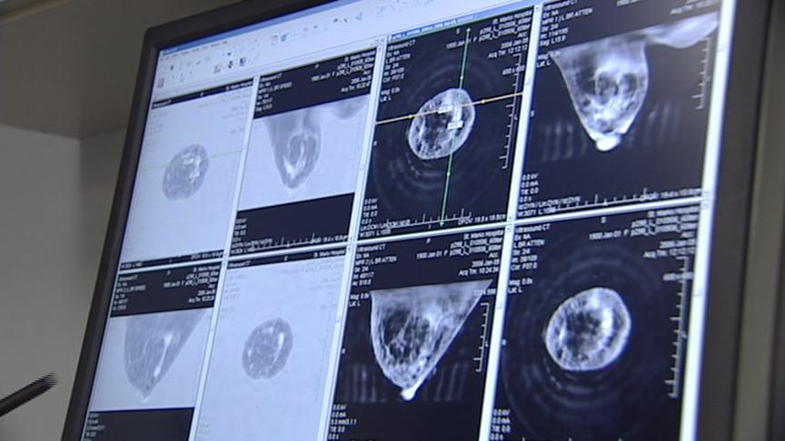 Utah Company Develops Revolutionary Breast Cancer Screening Device