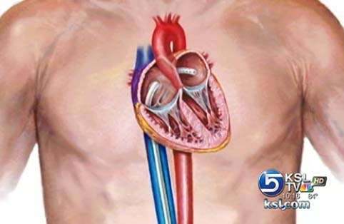 Patient makes 'phenomenal' recovery