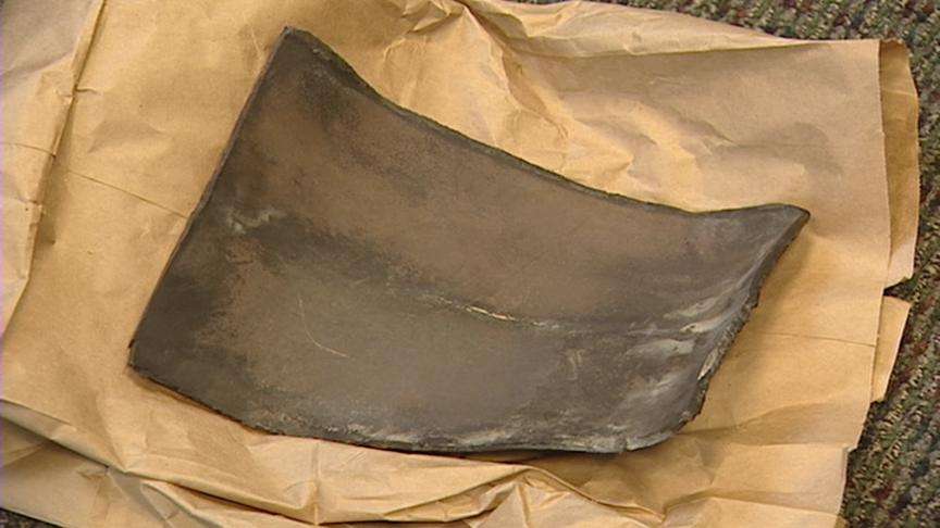 Doctors positive about saving leg of boy injured in blast