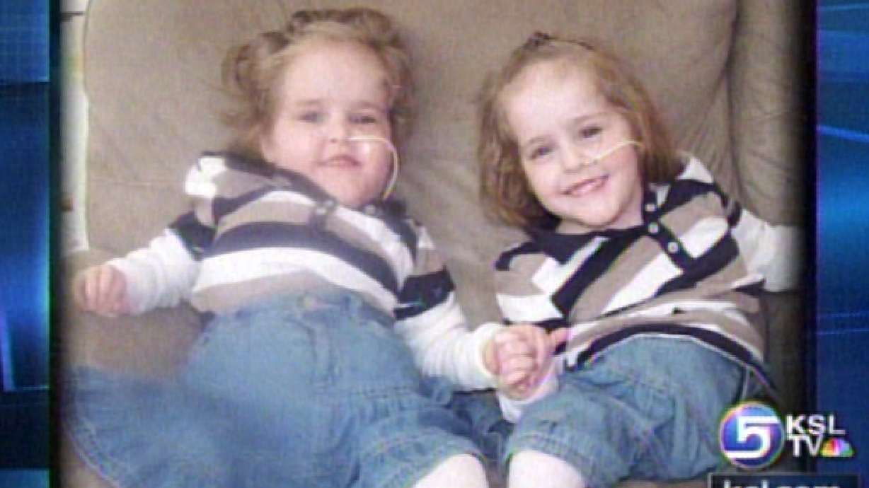 Herrin Twins Capture Hearts of Thousands