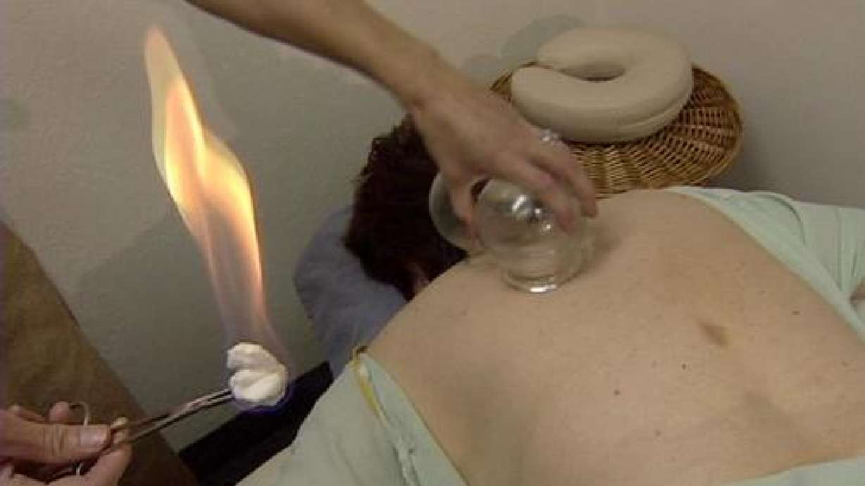 Eastern medicine available for injured athletes