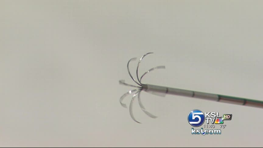 Minimally-invasive surgery being used to remove kidneys