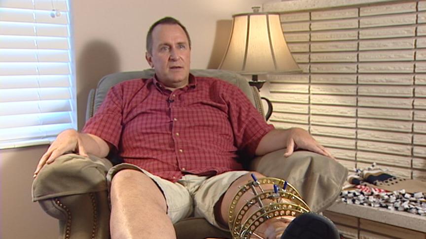 Utah AG undergoes 11th leg surgery