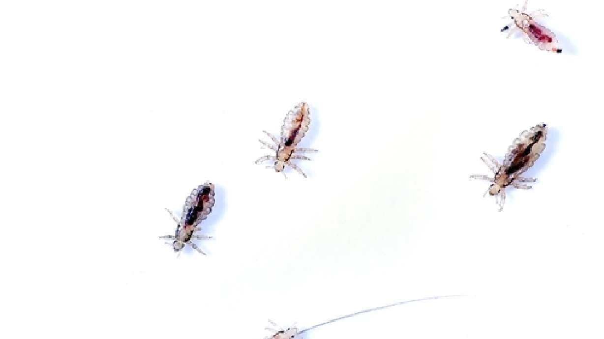 'Super lice' becoming more common