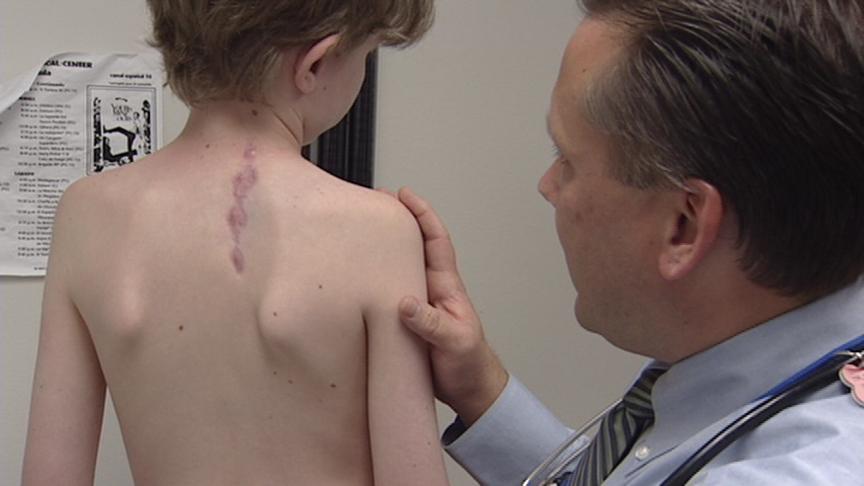 More Kids Getting Melanoma