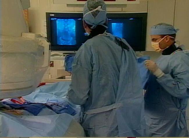 New Procedure to Remove Uterine Fibroid Tumors