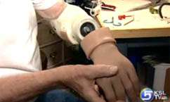 New Ointment Helps Soldiers With Amputations