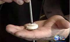 New Ointment Helps Soldiers With Amputations