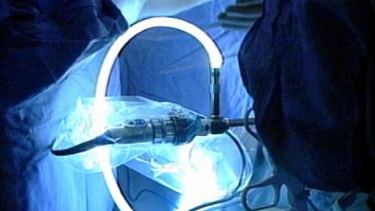 Gastric bypass appears to improve brain function