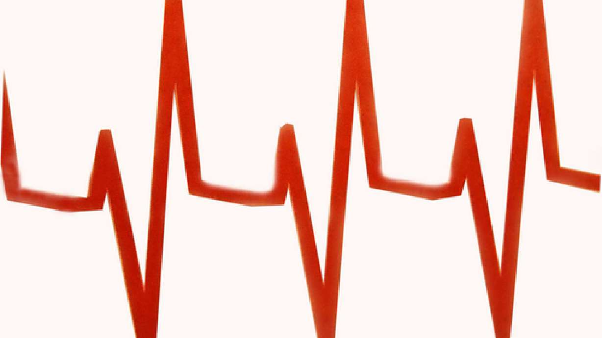 South Jordan making more defibrillators available