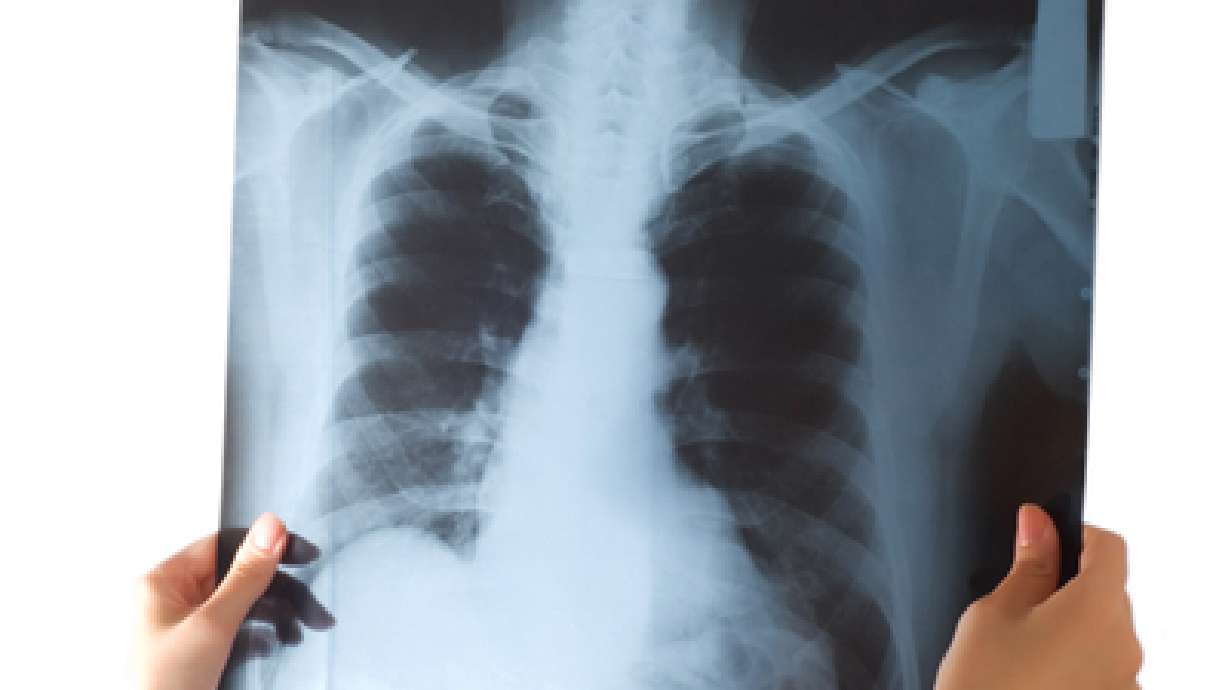 Intermountain to track radiation due to medical exams