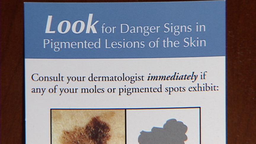 Skin Cancer Prevention