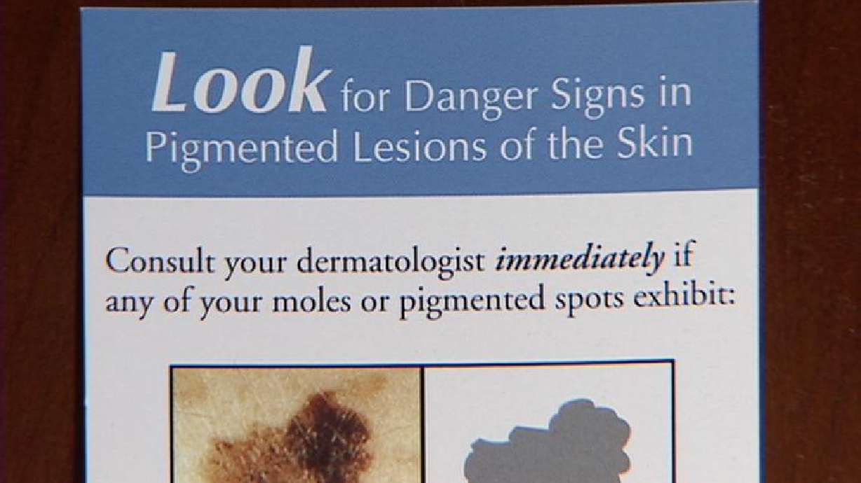 Skin Cancer Prevention