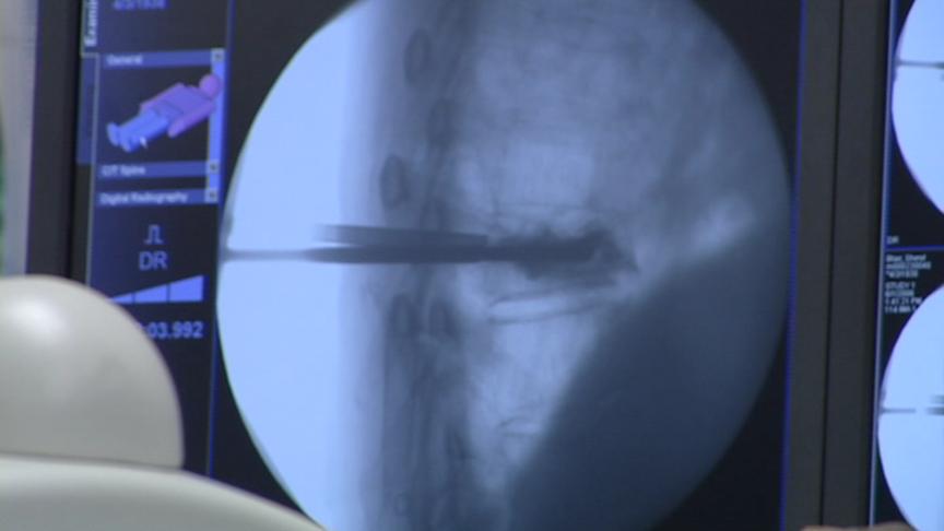 New System Makes Spine Surgery More Accurate