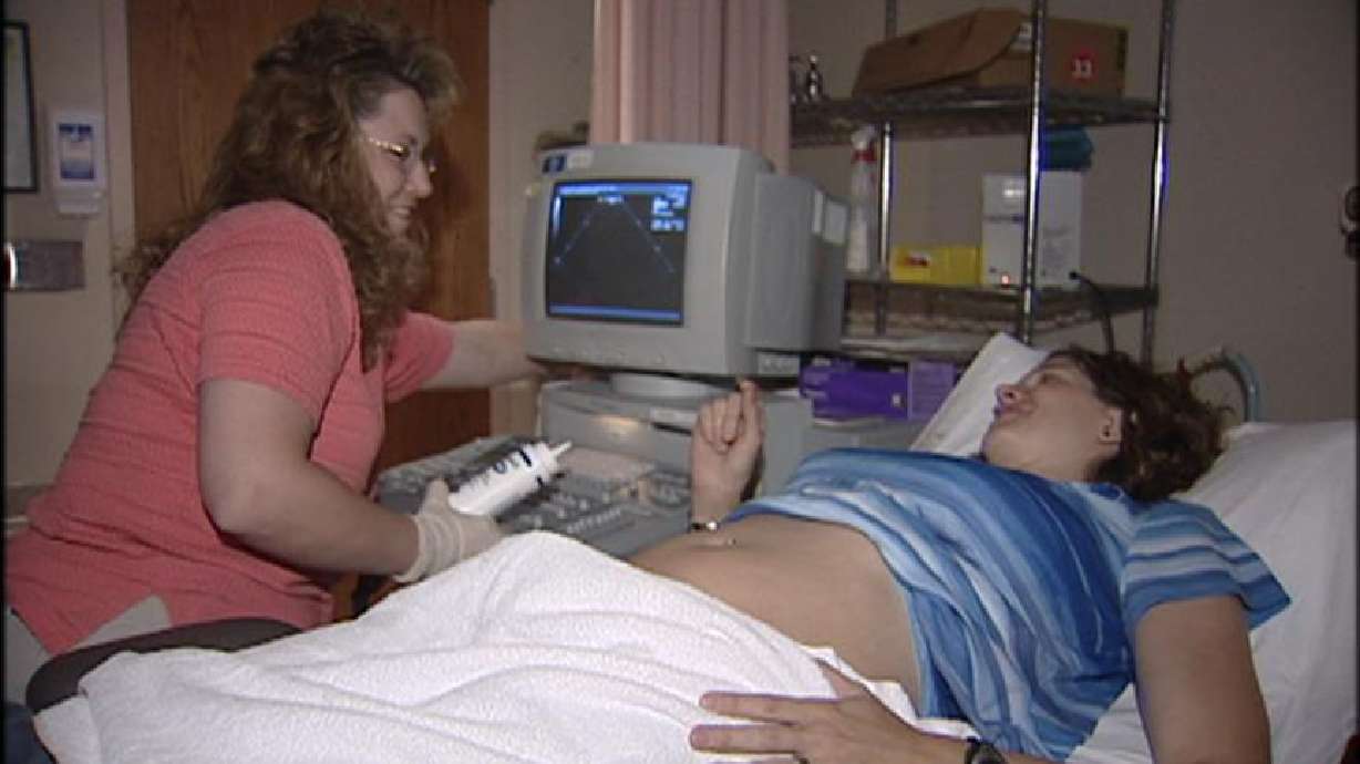 LDS Hospital to Study Fatal Heart Condition in Pregnant Mothers