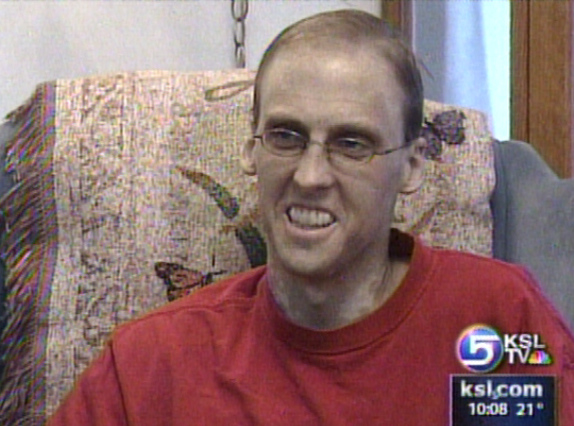 Man with Rare Disease Passes Away