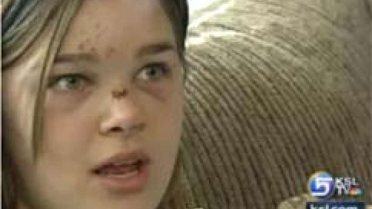 Police Search for Hit and Run Driver Who Injured Teens