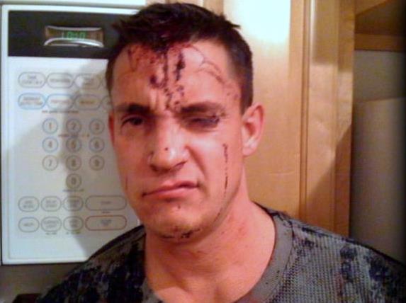 Mike Stidham following fight