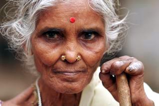 Utah mom fighting to end leprosy worldwide