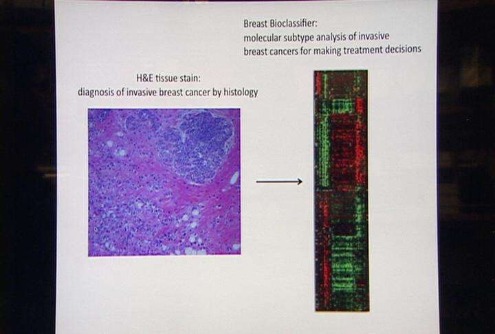 Huntsman cancer researchers bring new hope to breast cancer fight