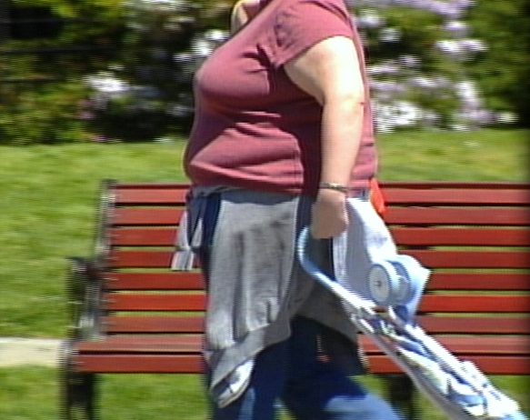 Birth defects now linked to obesity