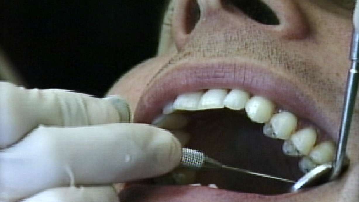 With economy going down, visits to the dentist are up
